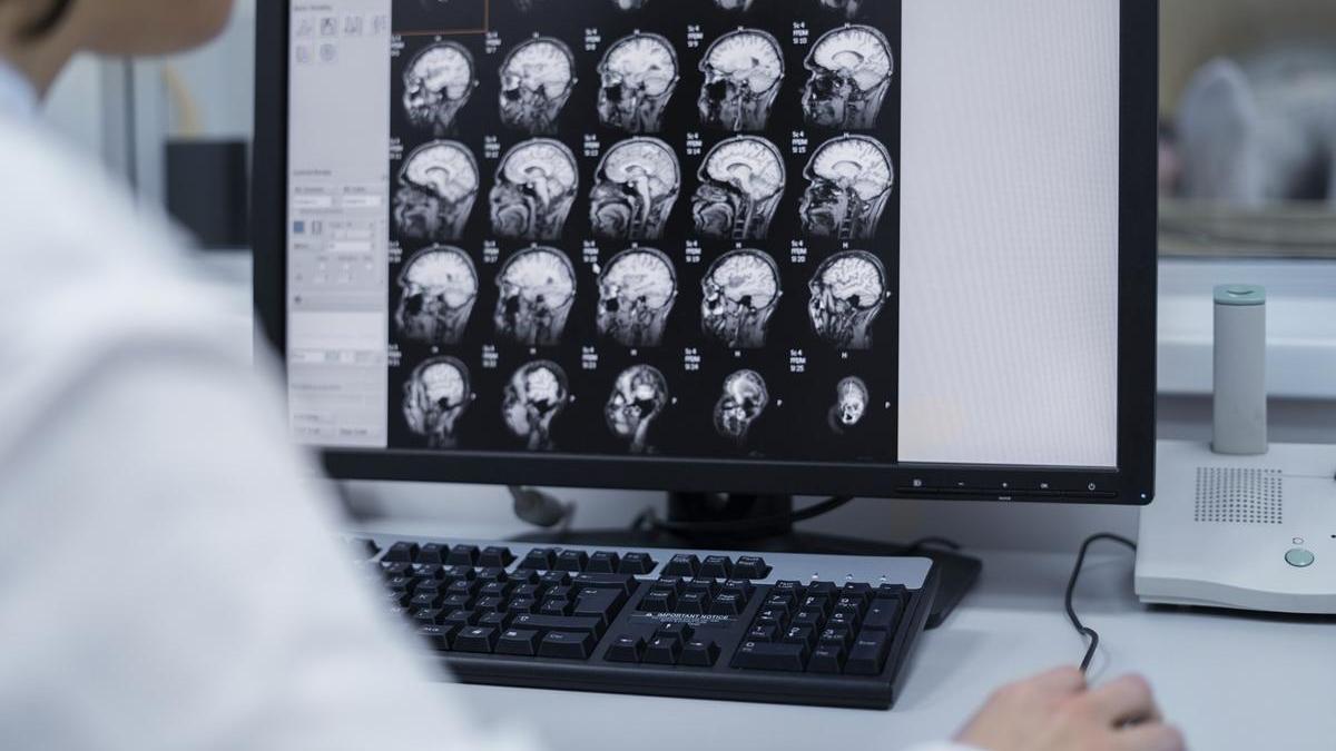 Una sanitaria analiza varias tomografías cerebrales.