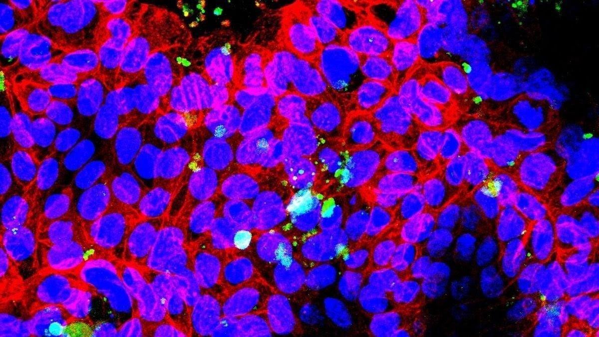 Las imágenes de microscopía muestran la capacidad de los nanoplásticos para interactuar con las células intestinales