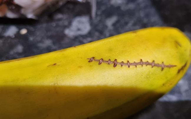 El plátano "cosido". / X (@GessamiMtnez) El plátano "cosido".