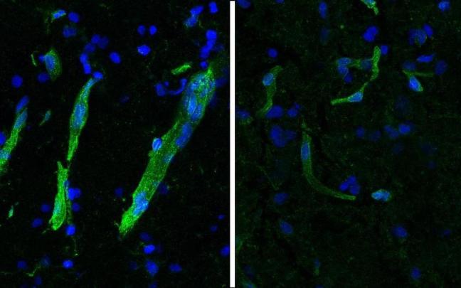 Tejido teñido de la corteza motora de un donante con ELA (derecha) muestra cantidades reducidas de la proteína HLA-E (verde) en la vasculatura. / HEIMAN LAB / MIT PICOWER INSTITUTE Tejido teñido de la corteza motora de un donante con ELA (derecha) muestra cantidades reducidas de la proteína HLA-E (verde) en la vasculatura.