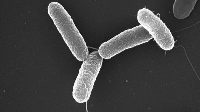 Imagen de archivo de un tipo de salmonela vista al microscopio.