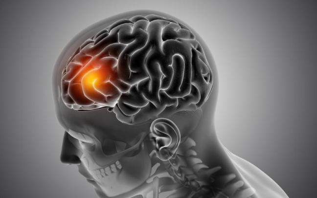 En Euskadi sufren más de 10.000 personas sufren Parkinson