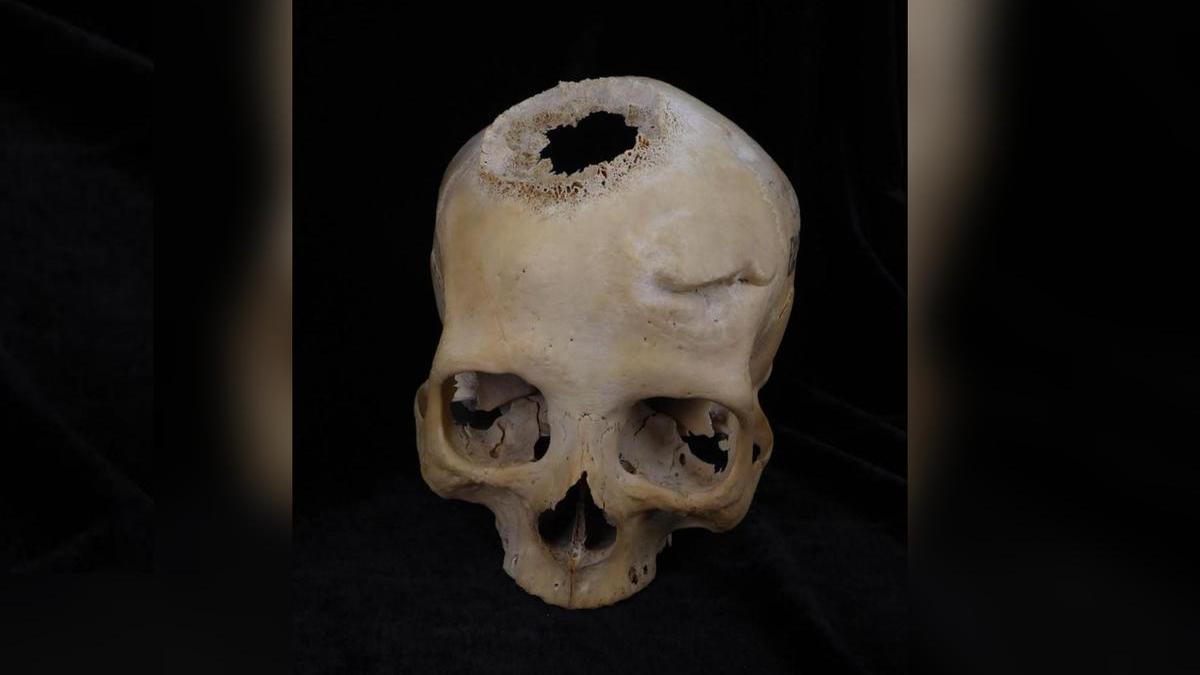 Imagen de un cráneo datado entre el 663 y el 343 a.C., y perteneciente a una mujer de más de 50 años.