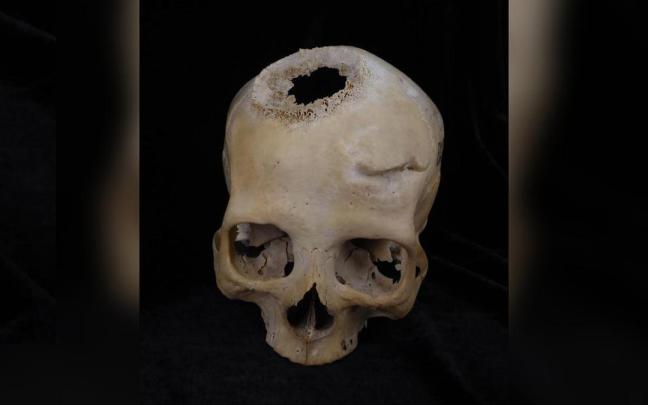 Imagen de un cráneo datado entre el 663 y el 343 a.C., y perteneciente a una mujer de más de 50 años.