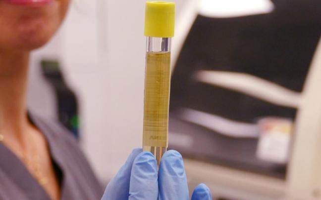 Una muestra de orina.