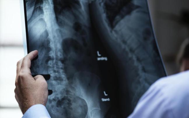 Un sanitario observa una radiografía.