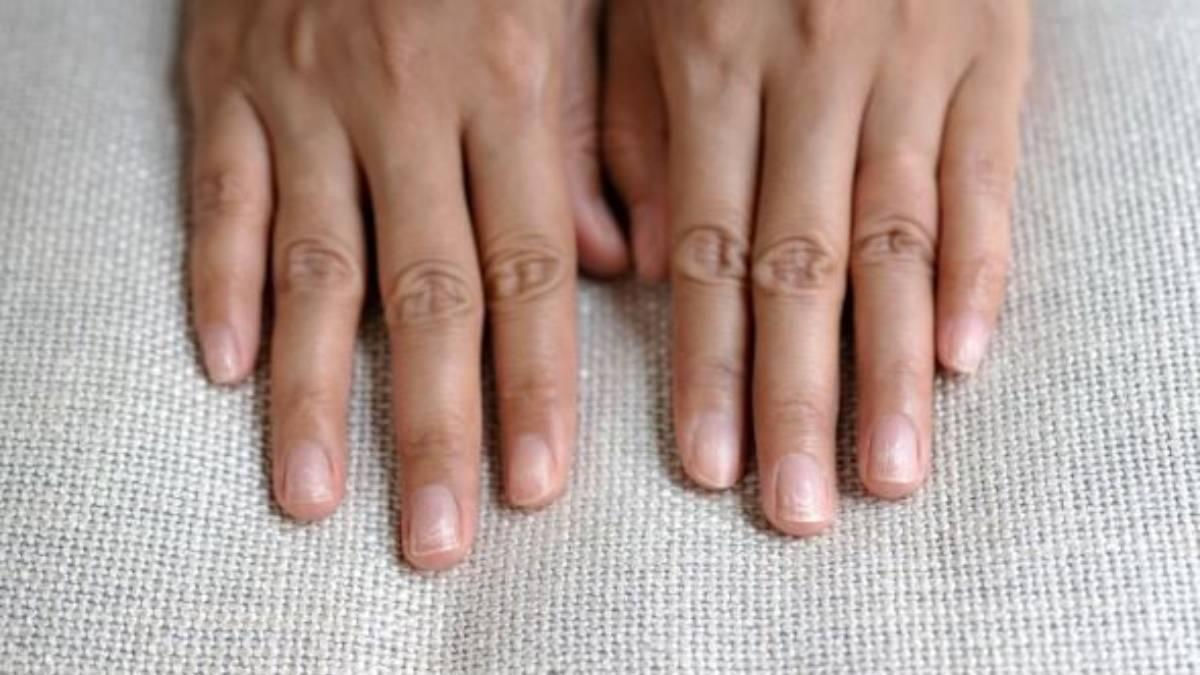 Cualquier cambio en su apariencia puede reflejar desequilibrios internos del cuerpo