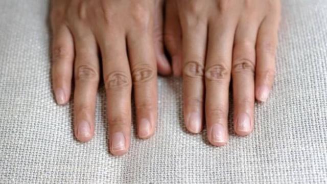 Cualquier cambio en su apariencia puede reflejar desequilibrios internos del cuerpo / Freepik Cualquier cambio en su apariencia puede reflejar desequilibrios internos del cuerpo