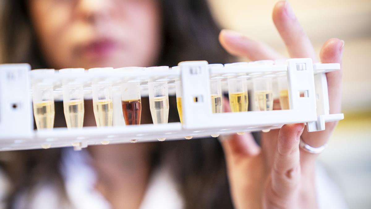 Estudio de Gluten3S.