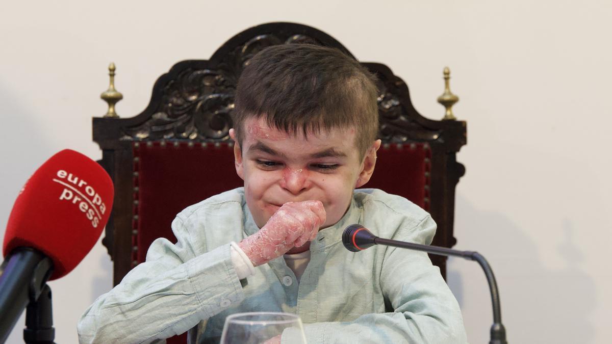 El pequeño Leo, que sufre la enfermedad ‘piel de mariposa'.