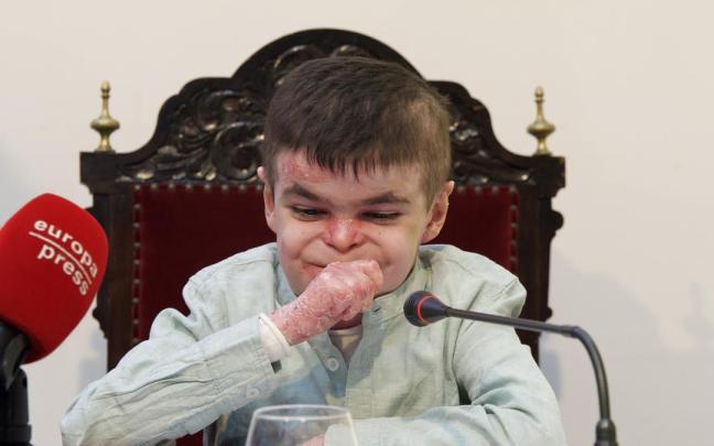 El pequeño Leo, que sufre la enfermedad ‘piel de mariposa'.