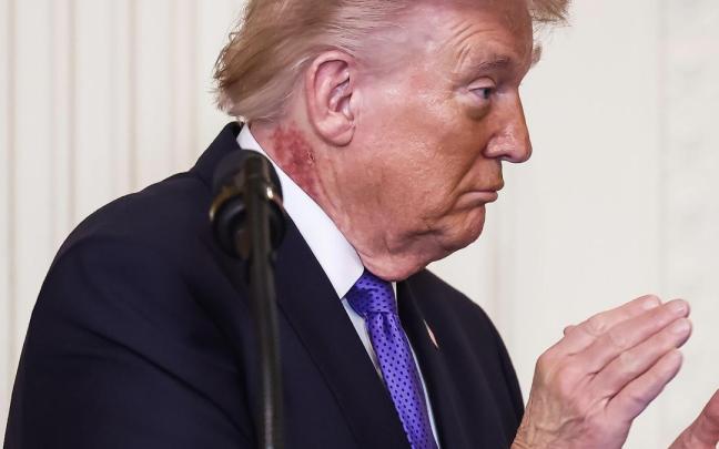 Trump, durante su comparecencia este lunes.