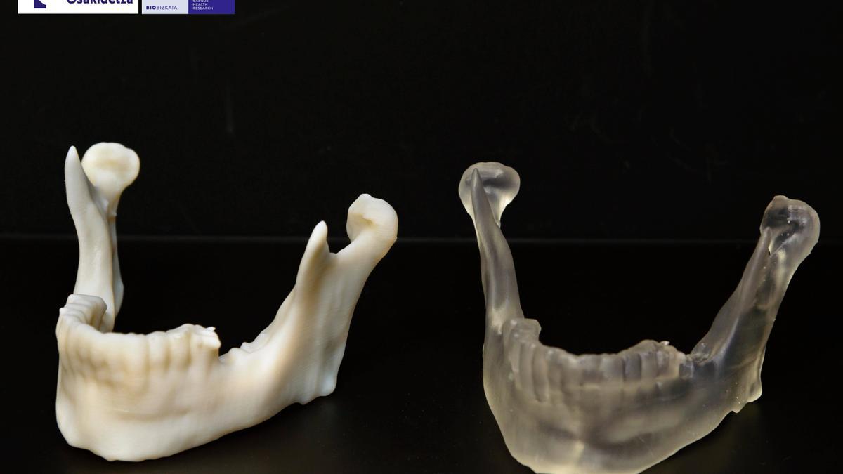 Modelos de mandíbula impresos en 3D para planificar intervenciones maxilofaciales adaptadas a la anatomía de cada paciente.