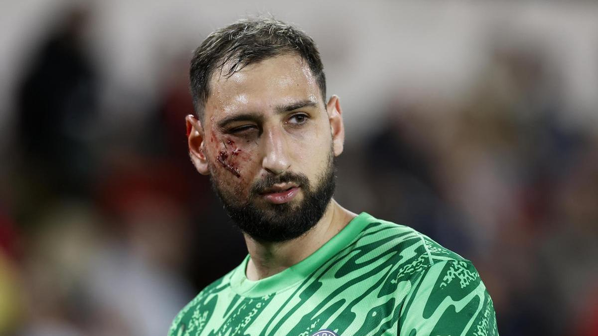 Gianluigi Donnarumma tras sufrir el fuerte golpe en la cara.