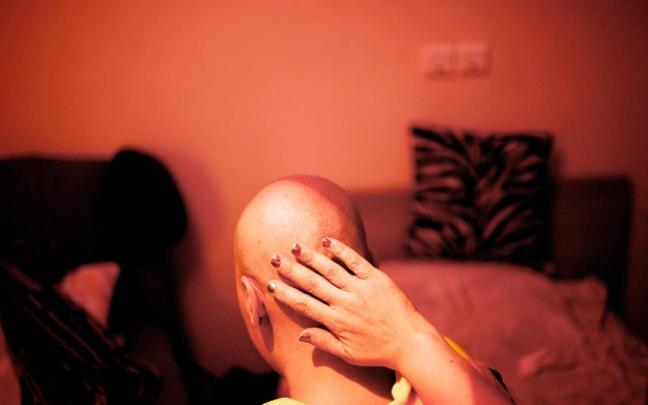 En la imagen, una persona que se ha sometido a un tratamiento oncológico