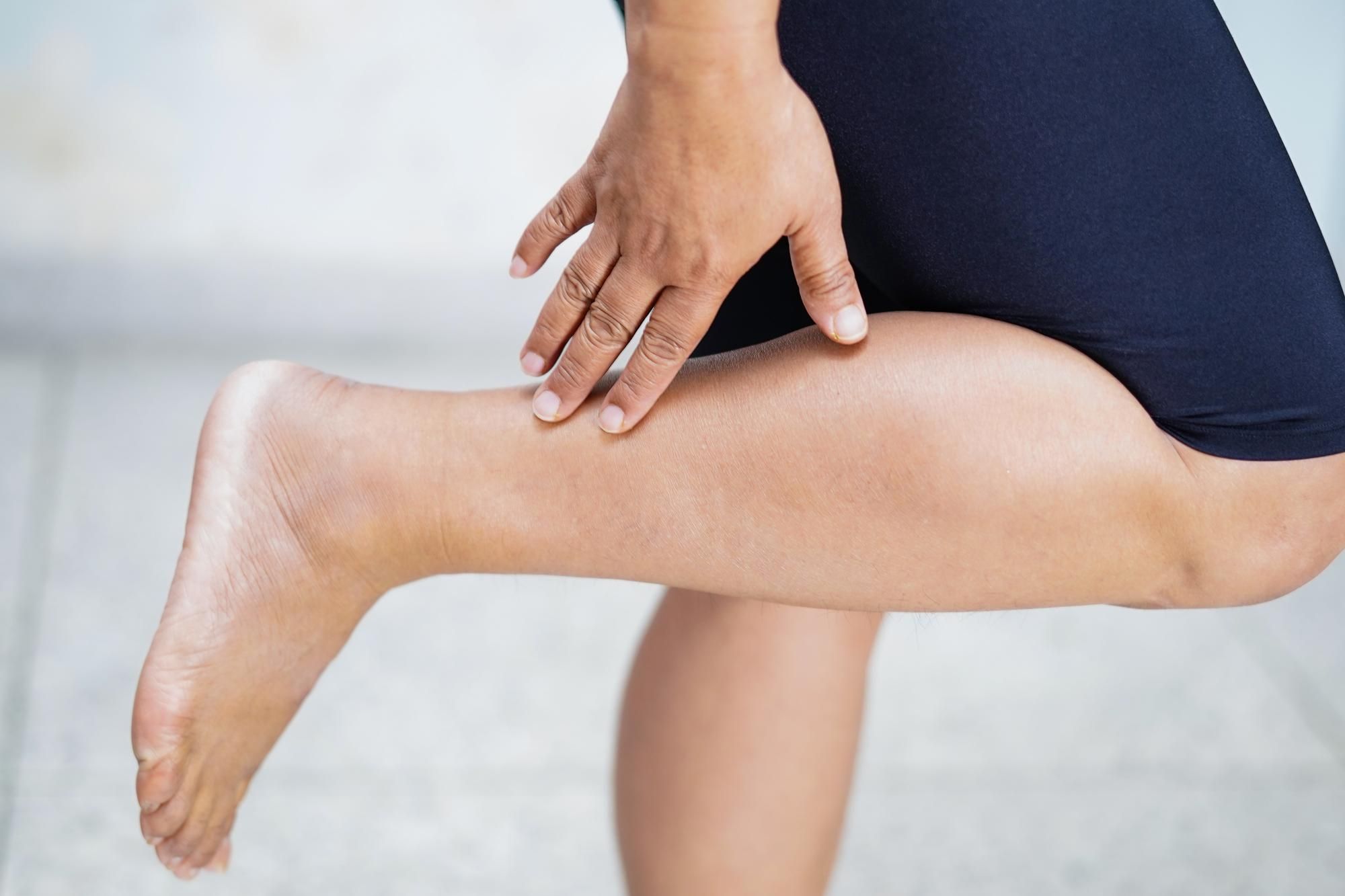 Una mujer con los tobillos hinchados.