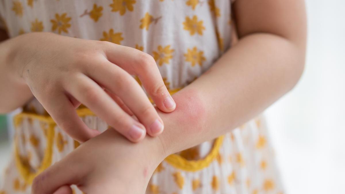 Algunas plantas aromáticas y los aceites esenciales extraídos de ellas pueden convertirse en un repelente natural y eficaz contra los mosquitos.