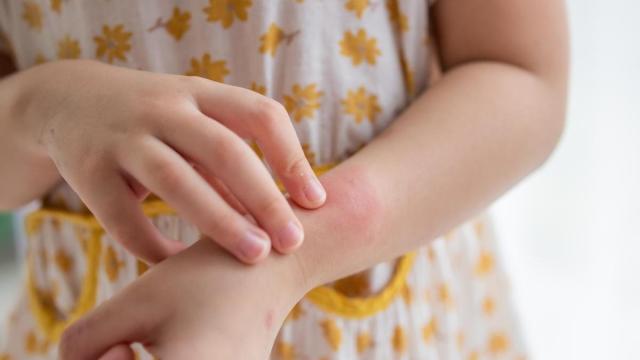 Algunas plantas aromáticas y los aceites esenciales extraídos de ellas pueden convertirse en un repelente natural y eficaz contra los mosquitos.