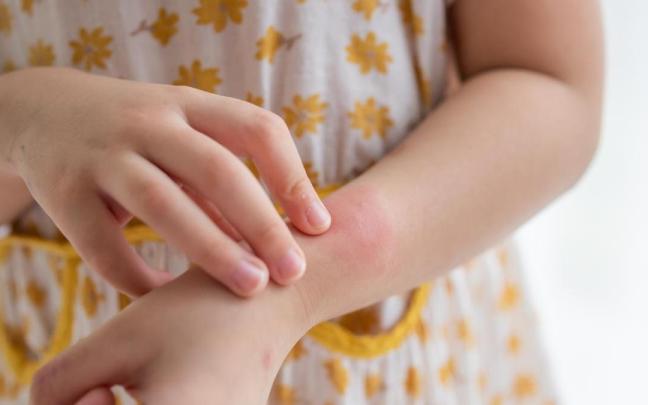 Algunas plantas aromáticas y los aceites esenciales extraídos de ellas pueden convertirse en un repelente natural y eficaz contra los mosquitos.