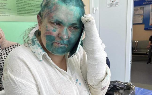 La periodista rusa Yelena Miláshina tras el ataque.