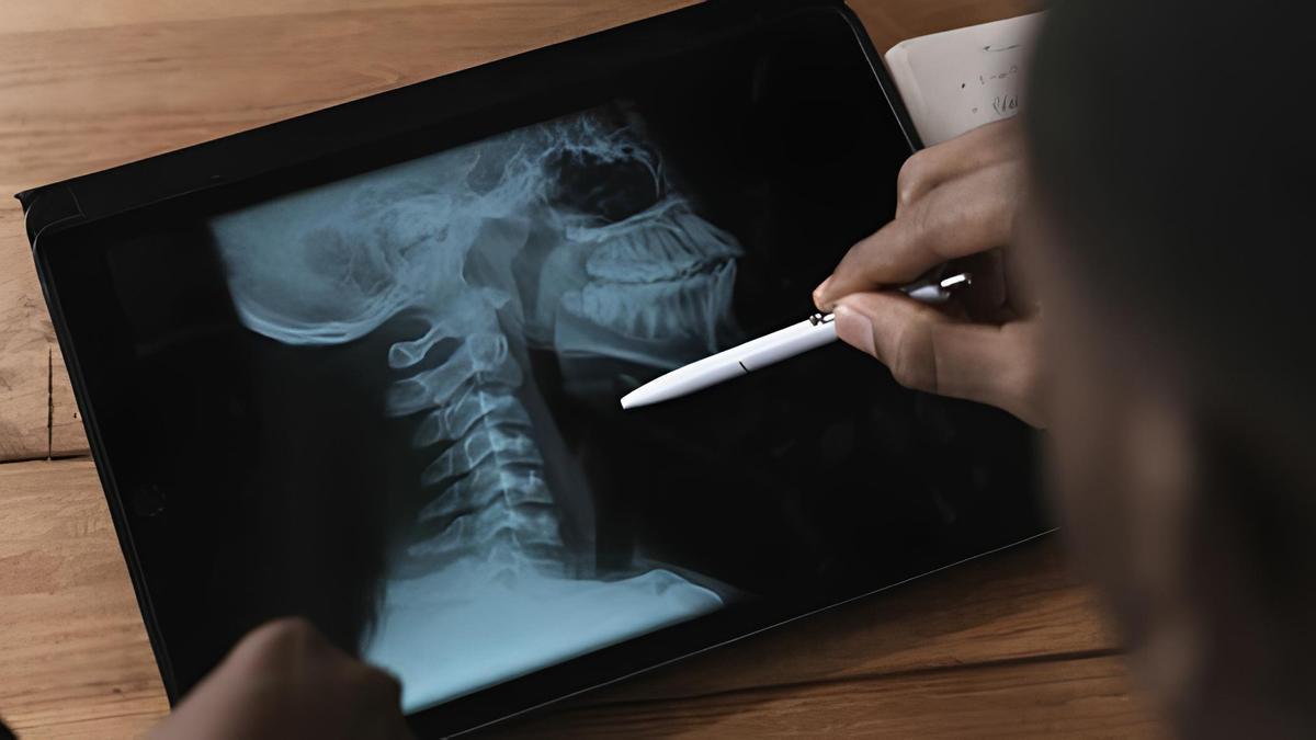 La Universidad de Deusto participa en una IA que predice la calidad de vida de supervivientes de cáncer de cabeza y cuello.