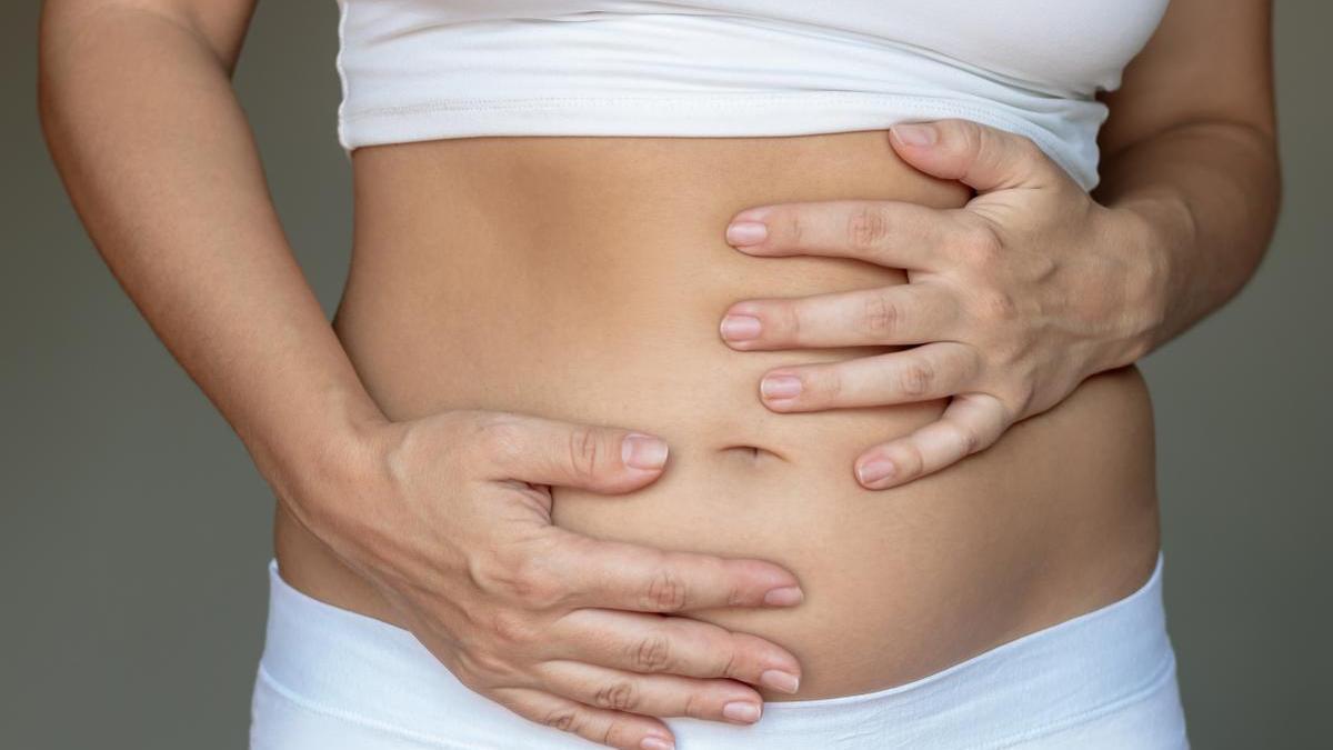 Abdomen de una mujer con diástasis abdominal.