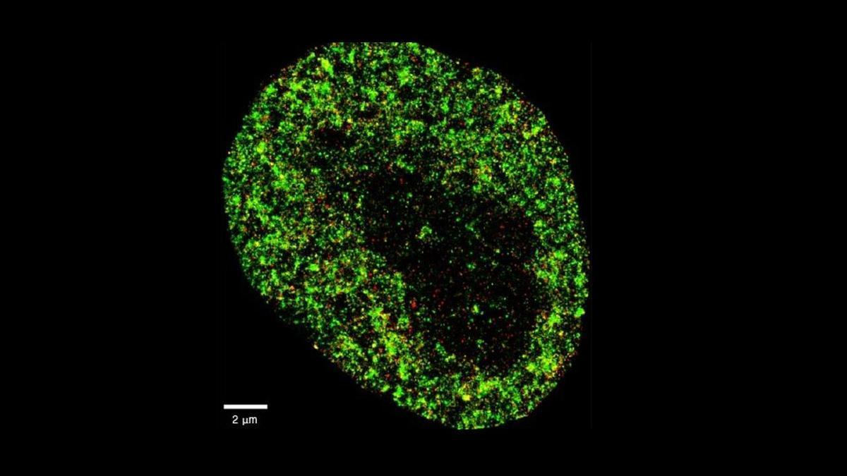 Imagen de altísima resolución de una célula cancerosa HeLa.