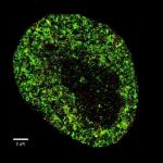 Imagen de altísima resolución de una célula cancerosa HeLa.