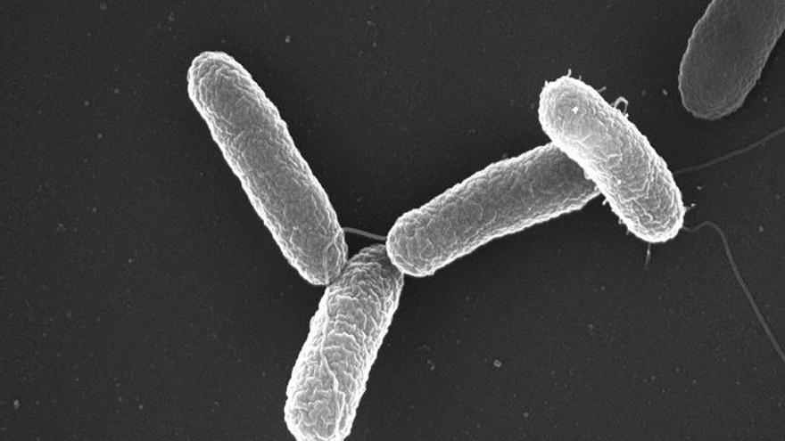 Imagen al microscopio de la bacteria Salmonella enterica serovar Typhimurium.