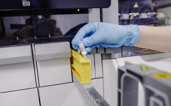Una investigadora coge una muestra de un virus para analizarla. Una investigadora coge una muestra de un virus para analizarla.