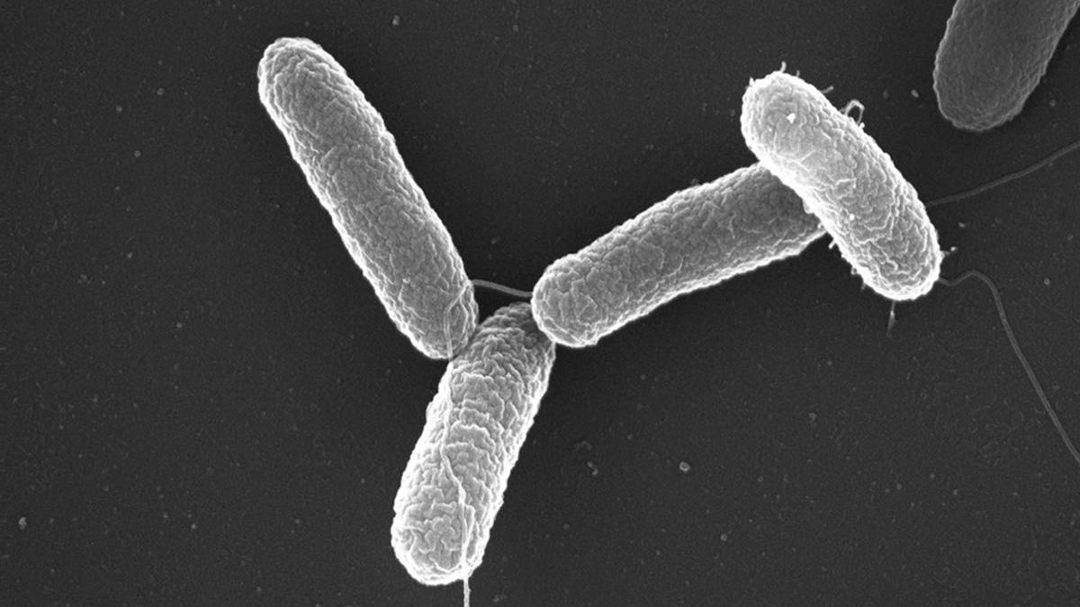 Imagen de archivo de un tipo de salmonela vista al microscopio.