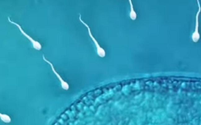 Unos espermatozoides, a la carrera. / Sperm Racing Unos espermatozoides, a la carrera.