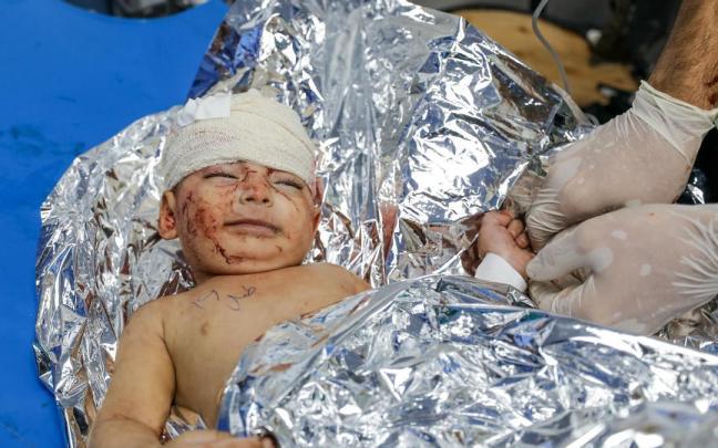 Un bebé palestino herido en los bombardeos israelíes sobre Gaza.