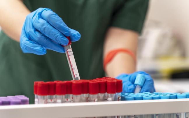 La hemofilia es una enfermedad poco frecuente por la que la sangre no coagula de la forma habitual