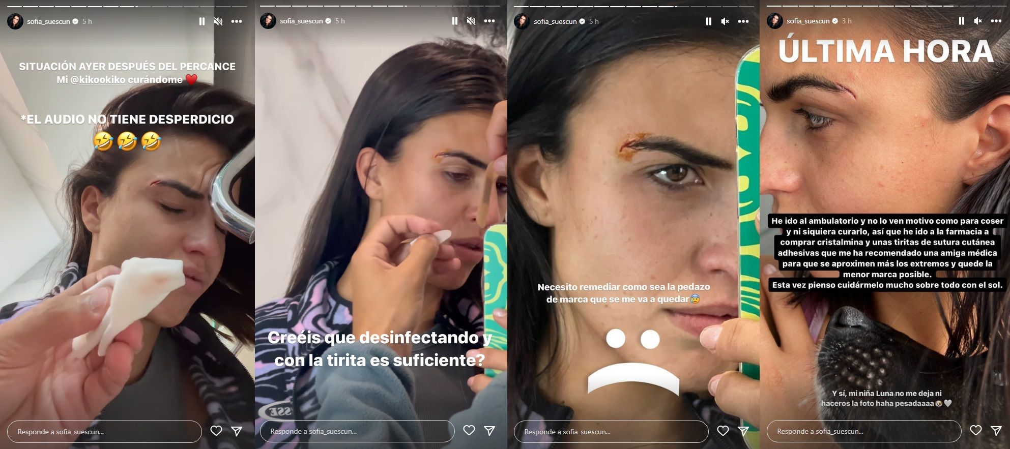 Varias de las historias relacionadas con la herida.
