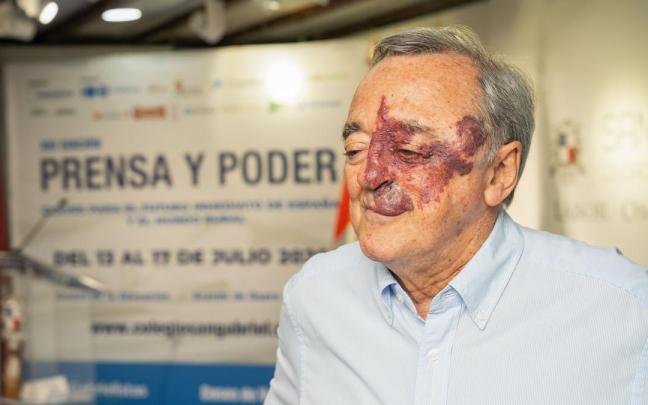 El jefe del Grupo de Oncología Experimental del Centro Nacional de Investigaciones Oncológicas (CNIO), Mariano Barbacid, atiende a la prensa.