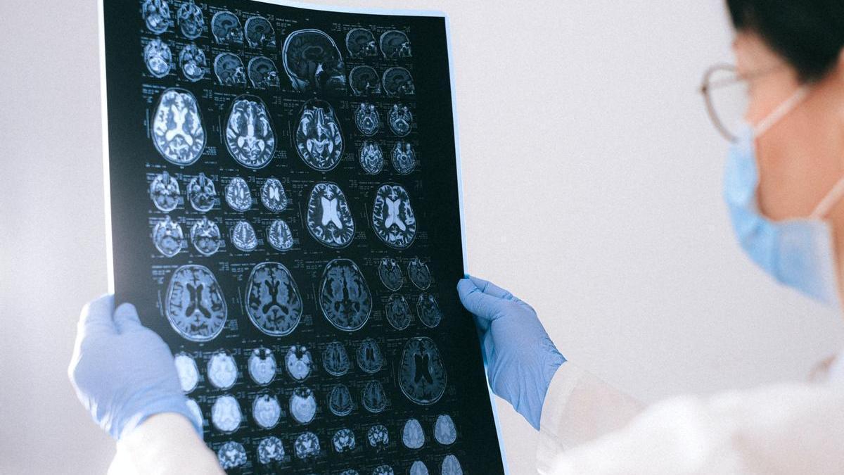 Una sanitaria observa las imágenes de una resonancia magnética cerebral.