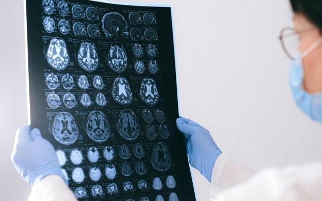 Una sanitaria observa las imágenes de una resonancia magnética cerebral. Una sanitaria observa las imágenes de una resonancia magnética cerebral.