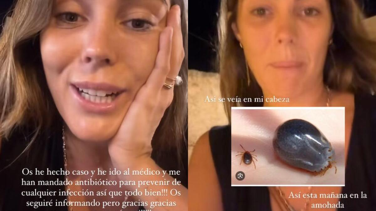 Anna Padilla actualiza su estado de salud tras encontrarse una garrapata en la piel