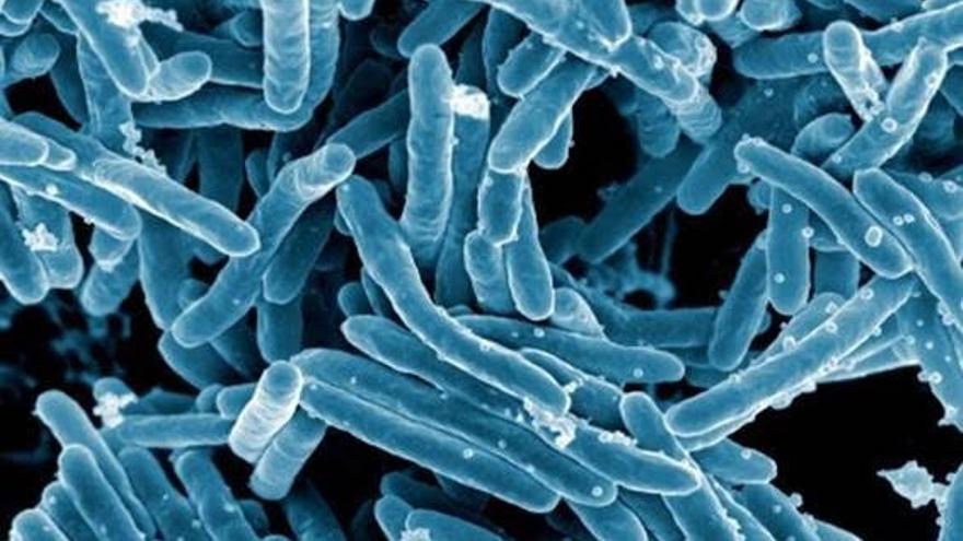 Imagen de microscopio de la bacteria Mycobacterium tuberculosis.