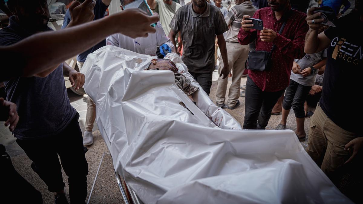 Un niño herido grave es trasladado al hospital Al-Aqsa de Gaza tras ser víctima de un bombardeo israelí.
