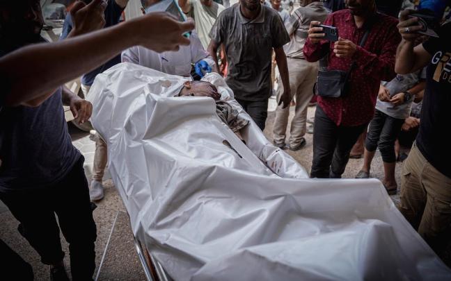 Un niño herido grave es trasladado al hospital Al-Aqsa de Gaza tras ser víctima de un bombardeo israelí.