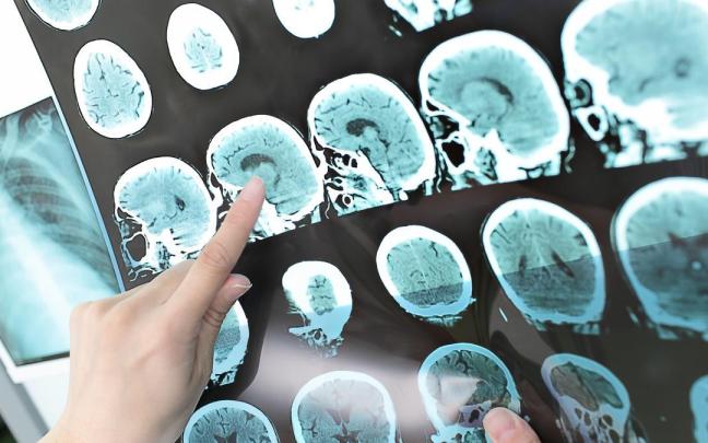 Imagen de archivo de una radiografía en Osakidetza.