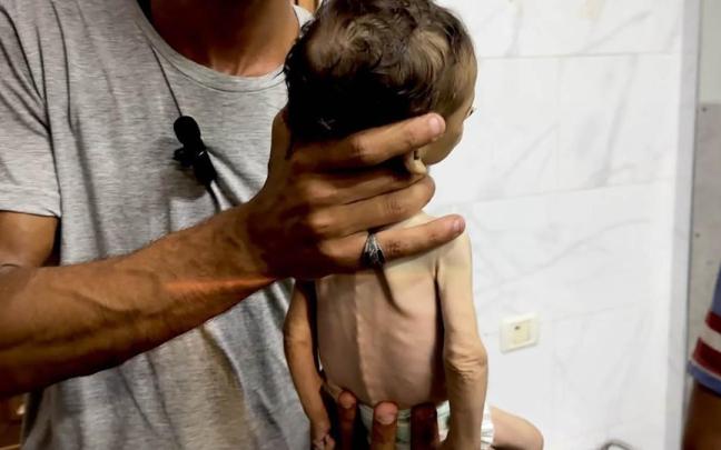 Un hombre sostiene a un bebé con graves síntomas de desnutrición en la Ciudad de Gaza. / EP Un hombre sostiene a un bebé con graves síntomas de desnutrición en la Ciudad de Gaza.