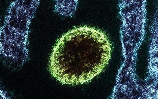 Virus Nipah. Virus Nipah.