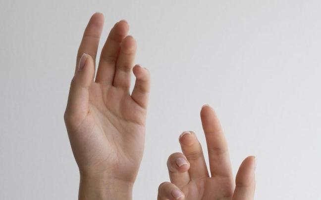 Los primeros síntomas son los problemas de movilidad de la mano y las malformaciones.