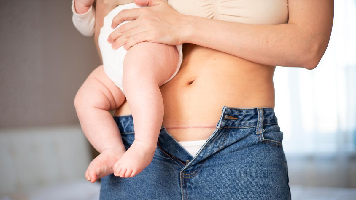Abdomen de una madre en el postparto con su hijo en brazos.