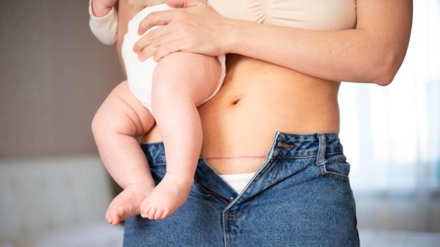 Abdomen de una madre en el postparto con su hijo en brazos.