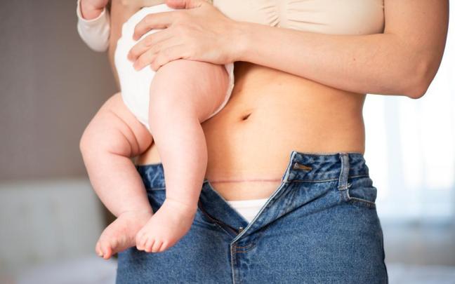 Abdomen de una madre en el postparto con su hijo en brazos.