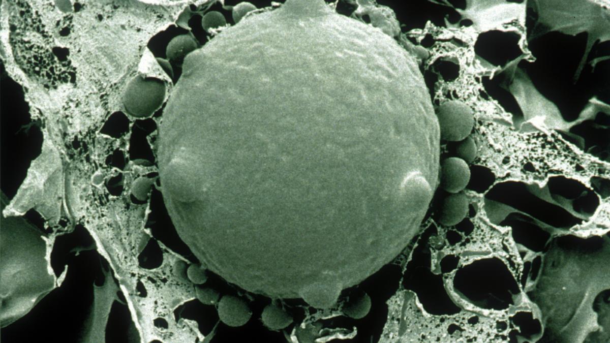 Micrografía de una zoospora y esporangios del hongo quítrido 'Batrachochytrium dendrobatidis'.